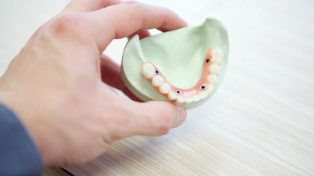 dental implants, reno cosmetic dentist, dental implants reno