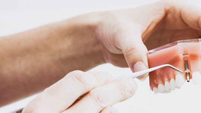 dental implants, reno cosmetic dentist
