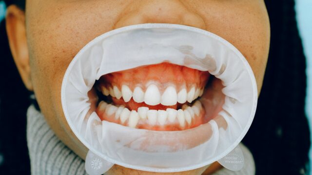 how to take care of your gums