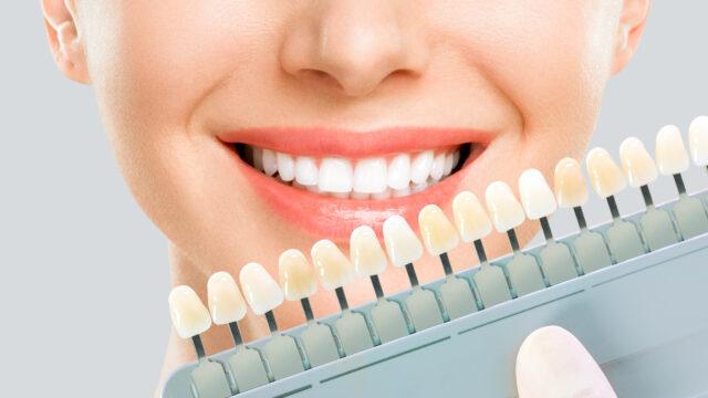 cosmetic dentistry, reno cosmetic dentist, nevada dentists