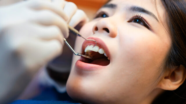 Girl getting her teeth cleaned by a dentist for teeth whitening in reno
